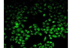 Detection of PIK3AP1 in Human Hela Cells using Polyclonal Antibody to Phosphoinositide-3-Kinase Adaptor Protein 1 (PIK3AP1) (PIK3AP1 抗体  (AA 489-730))