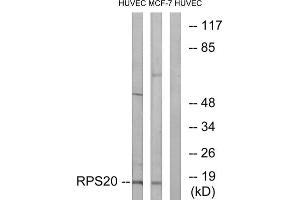 Western blot analysis of extracts from HUVEC cells and MCF-7 cells, using RPS20 antibody. (RPS20 抗体  (Internal Region))