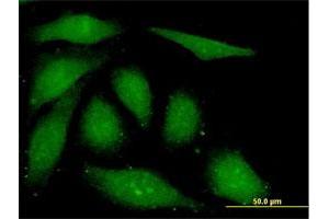 Immunofluorescence of monoclonal antibody to FGF1 on HeLa cell. (FGF1 抗体  (AA 46-155))