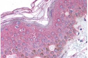 Human Skin (formalin-fixed, paraffin-embedded) stained with BARD1 antibody ABIN214634 at 10 ug/ml followed by biotinylated goat anti-rabbit IgG secondary antibody ABIN481713, alkaline phosphatase-streptavidin and chromogen. (BARD1 抗体  (AA 108-124))