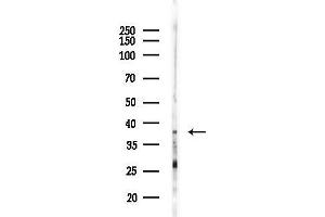 anti-Stearoyl-CoA Desaturase (Delta-9-Desaturase) (SCD) (N-Term) antibody