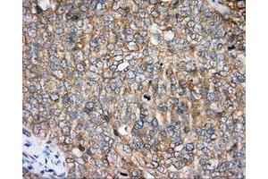 Immunohistochemistry (IHC) image for anti-Bruton Agammaglobulinemia tyrosine Kinase (BTK) antibody (ABIN1496974) (BTK 抗体)