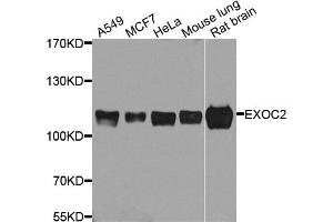 Western blot analysis of extracts of various cell lines, using EXOC2 antibody. (EXOC2 抗体)