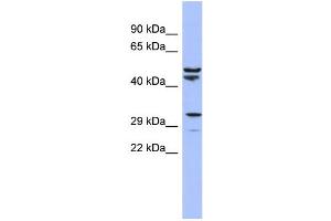 WB Suggested Anti-MRPS15 Antibody Titration:  0. (MRPS15 抗体  (N-Term))