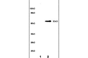 Lane 1: rat brain lysates Lane 2: rat kidney lysates probed with Anti CYP11A1 P450SCC Polyclonal Antibody, unconjugated (ABIN701530) at 1:200 in 4 °C Followed by conjugation to secondary antibody (ABIN727474-HRP) at 1:3000 90min in 37 °C Predicted band 53kD. (CYP11A1 抗体  (AA 321-420))