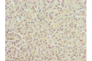 Immunohistochemistry of paraffin-embedded human pancreatic tissue using ABIN7173131 at dilution of 1:100 (TMEM25 抗体  (AA 104-153))