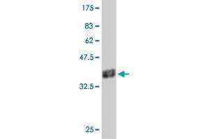 Western Blot detection against Immunogen (37. (PHF5A 抗体  (AA 1-110))