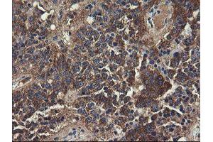 Image no. 11 for anti-Ubiquitin-Conjugating Enzyme E2, J1, U (UBE2J1) antibody (ABIN1501638)