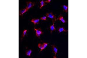 Image no. 3 for anti-Nanos Homolog 1 (NANOS1) (C-Term) antibody (ABIN356876) (Nanos Homolog 1 抗体  (C-Term))
