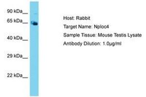 Image no. 1 for anti-Nuclear Protein Localization 4 Homolog (NPLOC4) (AA 96-145) antibody (ABIN6750475) (NPLOC4 抗体  (AA 96-145))