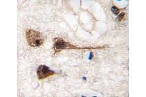 IHC analysis of FFPE human brain tissue stained with MEF2C antibody (MEF2C 抗体  (AA 278-307))