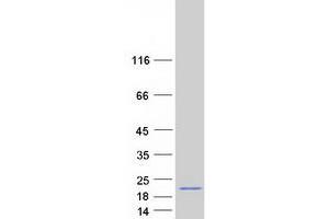 Western Blotting (WB) image for Regenerating Islet Derived Protein 3 gamma (REG3g) (Transcript Variant 2) protein (Myc-DYKDDDDK Tag) (ABIN2730689)