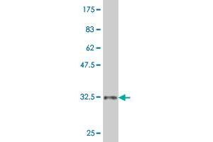 Western Blot detection against Immunogen (34. (ZIC1 抗体  (AA 139-212))