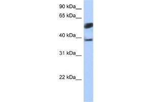 WB Suggested Anti-SPOPL Antibody Titration:  0.