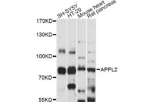 Western blot analysis of extracts of various cell lines, using APPL2 antibody (ABIN6292794) at 1:1000 dilution. (APPL2 抗体)