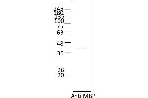 Western Blotting (WB) image for Ataxin 2 (ATXN2) (AA 1-1313) protein (ABIN3089810)