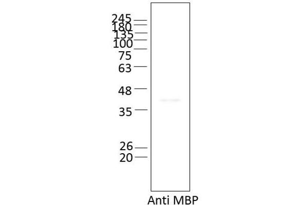 Ataxin 2 Protein (ATXN2) (AA 1-1313) (Strep Tag)