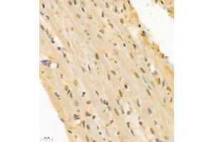 Immunohistochemistry of paraffin embedded rat heart using ZNF106 (ABIN7076260) at dilution of 1:300 (400x lens) (ZFP106 抗体)