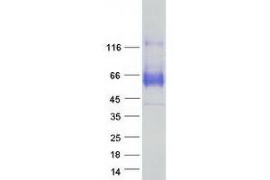 Western Blotting (WB) image for Synaptotagmin I (SYT1) (Transcript Variant 1) protein (Myc-DYKDDDDK Tag) (ABIN2733065)