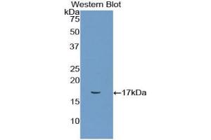 Western blot analysis of the recombinant protein. (CD72 抗体  (AA 126-237))