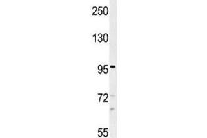 Western Blotting (WB) image for anti-Transient Receptor Potential Cation Channel, Subfamily M, Member 8 (TRPM8) (AA 69-98) antibody (ABIN3029241)