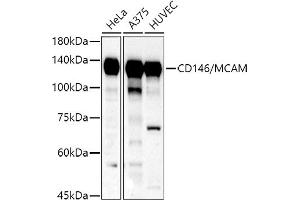 Western blot analysis of extracts of various cell lines, using CD146/MCAM antibody (ABIN6127568, ABIN6143621, ABIN6143622 and ABIN6218100) at 1:500 dilution. (MCAM 抗体  (AA 447-646))