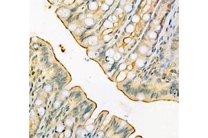 Immunohistochemistry (Paraffin-embedded Sections) (IHC (p)) image for anti-Solute Carrier Family 6 (Neutral Amino Acid Transporter), Member 19 (SLC6A19) antibody (ABIN7075682)