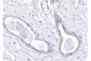 Immunohistochemistry of FAM175A in human breast tissue with FAM175A polyclonal antibody  at 5 ug/mL . (CCDC98 抗体  (N-Term))