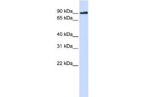 WB Suggested Anti-DCLRE1C Antibody Titration:  0. (DCLRE1C 抗体  (N-Term))