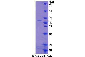 SDS-PAGE analysis of Human ACAA1 Protein. (ACAA1 蛋白)