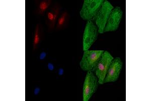 ABIN6257152 and ABIN6273721 staining  cells by IF/ICC. (E2F8 抗体  (C-Term))