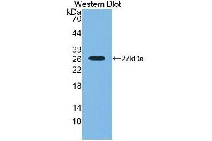 Western blot analysis of the recombinant protein. (SNX18 抗体  (AA 411-614))