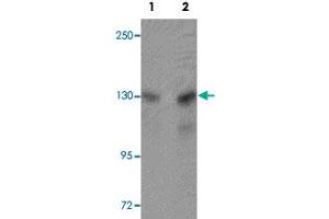 Western blot analysis of A-20 cells with MTUS2 polyclonal antibody  at (Lane 1) 0.