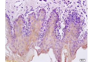 Formalin-fixed and paraffin embedded rat tongue labeled with Rabbit Anti Cytokeratin 5/CK5 Polyclonal Antibody, Unconjugated (ABIN737061) at 1:200 followed by conjugation to the secondary antibody and DAB staining (Cytokeratin 5 抗体  (AA 331-430))