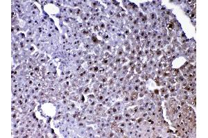 IHC analysis of PARK7 / DJ1 using anti-PARK7 / DJ1 antibody . (PARK7/DJ1 抗体  (AA 2-189))