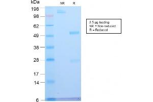 SDS-PAGE Analysis Purified ATRX Rabbit Recombinant Monoclonal Antibody (ATRX/2900R). (Recombinant ATRX 抗体)