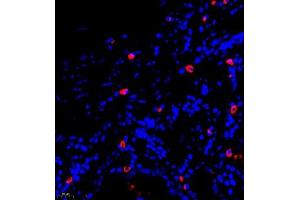 Immunofluorescence of paraffin embedded human stomach using GLP1 (ABIN7074053) at dilution of 1:500 (400x lens)
