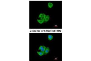 ICC/IF Image Immunofluorescence analysis of methanol-fixed A549, using AGR3, antibody at 1:200 dilution. (AGR3 抗体  (Center))