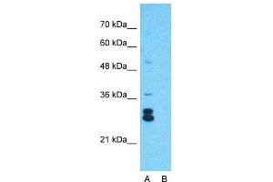 Western Blotting (WB) image for anti-KIT Ligand (KITLG) (Middle Region) antibody (ABIN2781827)
