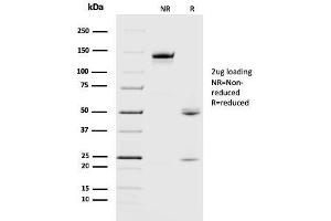SDS-PAGE (SDS) image for anti-Crystallin, alpha B (CRYAB) antibody (ABIN6939187)