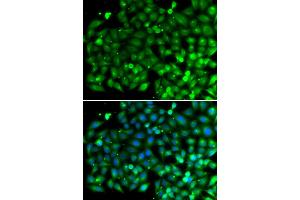 Immunofluorescence analysis of A549 cells using SH3GLB1 antibody (ABIN5974271). (SH3GLB1 抗体)