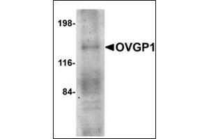Western blot analysis of OVGP1 in human placenta tissue lysate with this product at 1 μg/ml. (OVGP1 抗体  (N-Term))