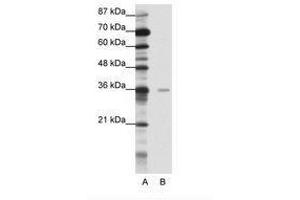 Image no. 1 for anti-Methyl-CpG Binding Domain Protein 2 (MBD2) (AA 151-200) antibody (ABIN202197)