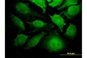Immunofluorescence (IF) image for anti-Thyroid Hormone Receptor Interactor 6 (TRIP6) (AA 51-148) antibody (ABIN563260)
