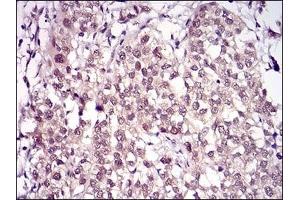 anti-Importin 9 (IPO9) (AA 453-680) antibody