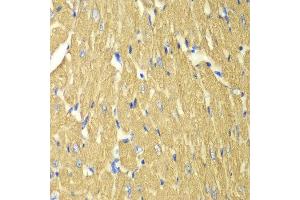 Immunohistochemistry (IHC) image for anti-Tropomyosin 3 (TPM3) (AA 1-284) antibody (ABIN6215629) (TPM3 抗体  (AA 1-284))