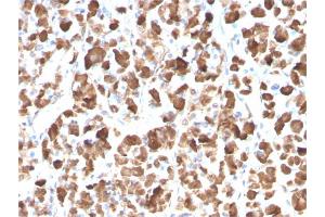 Immunohistochemistry (IHC) image for anti-Growth Hormone 1 (GH1) antibody (ABIN6939514)
