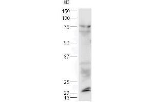 Lane 1: mouse lung probed with Rabbit Anti-Sclerostin Polyclonal Antibody, Unconjugated  at 1:5000 for 90 min at 37˚C. (Sclerostin 抗体  (AA 121-180))
