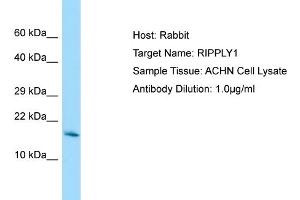 Host: Rabbit Target Name: RIPPLY1 Sample Tissue: Human ACHN Whole Cell Antibody Dilution: 1ug/ml (RIPPLY1 抗体  (Middle Region))