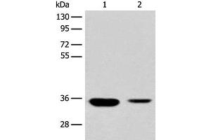 Western blot analysis of Mouse liver tissue and Human fetal liver tissue lysates using RGN Polyclonal Antibody at dilution of 1:500 (Regucalcin 抗体)